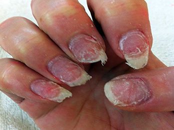 The Benefits of Acrylic Nails