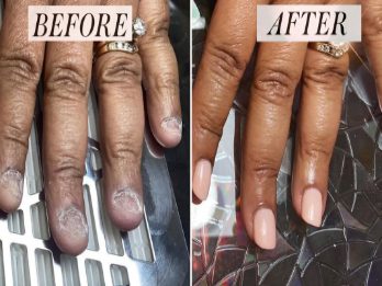 What Are The Benefits Of Using Cuticle Oil For Nails?
